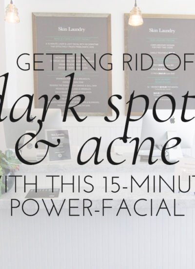 Skin Laundry Laser & Light Facial: Getting rid of Dark Spots